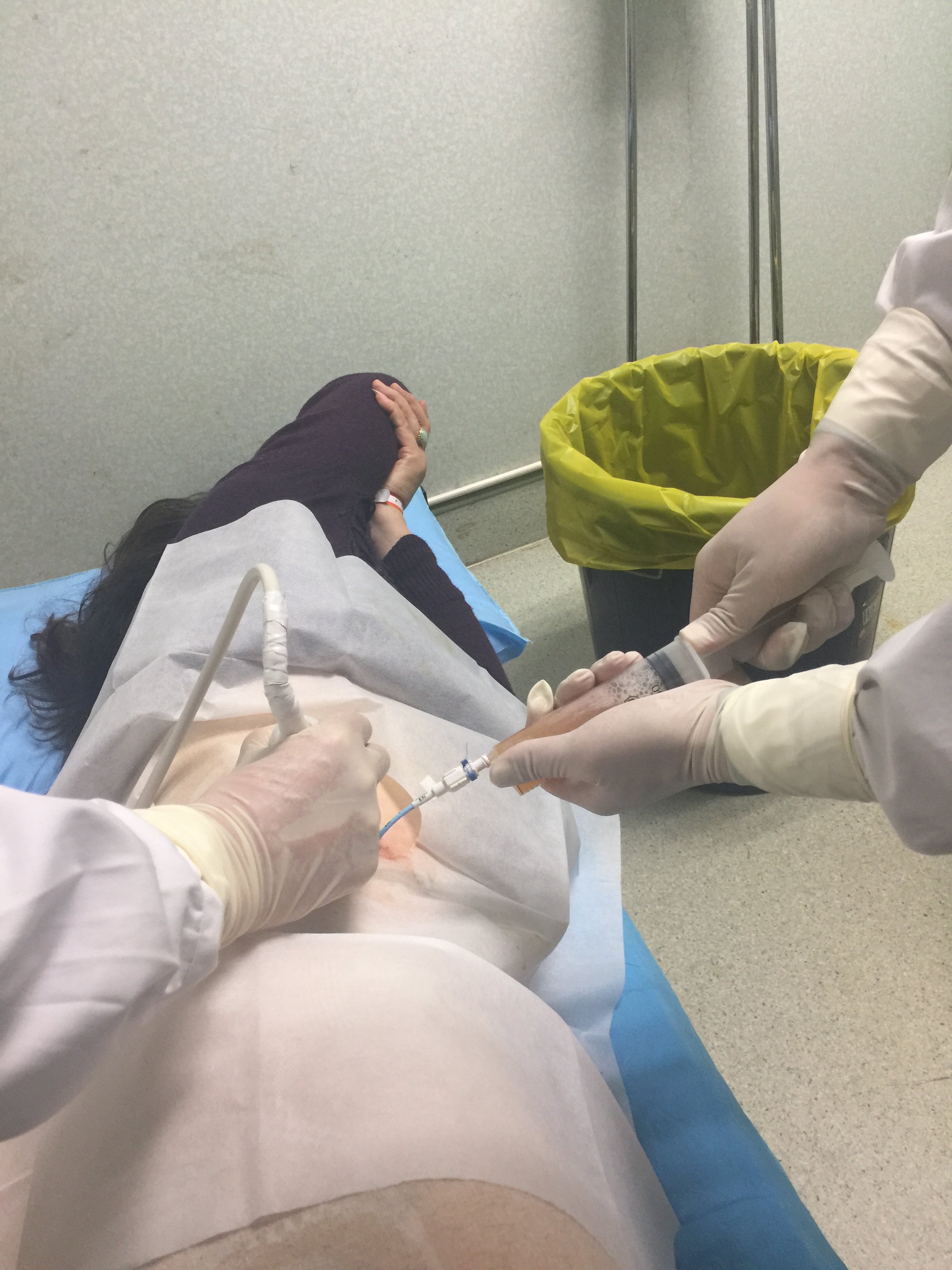 肝脓肿b超引导下穿刺置管引流 - 好大夫在线