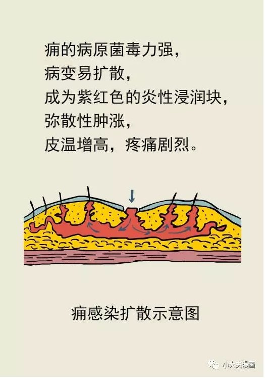 小大夫漫画之唇痈多可怕_痈_症状_治疗方法_症状表现_治疗方式 - 好