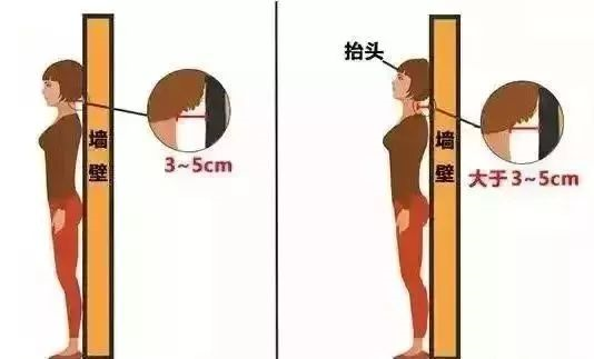 一个动作可自测"含胸驼背"程度