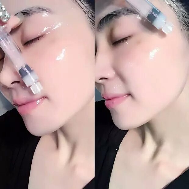 今日科普打水光针前你肯定想问这些