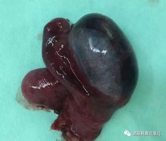 暂无