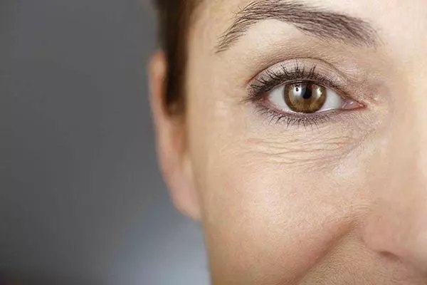 眼周年轻化,从了解眼部肌肤年龄开始 - 好大夫在线