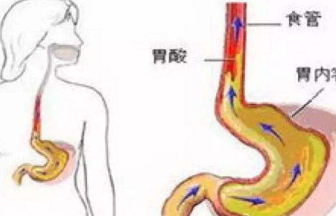 胃食管反流病科創始人,首都醫科大學血管外科研究所所長,主任醫師