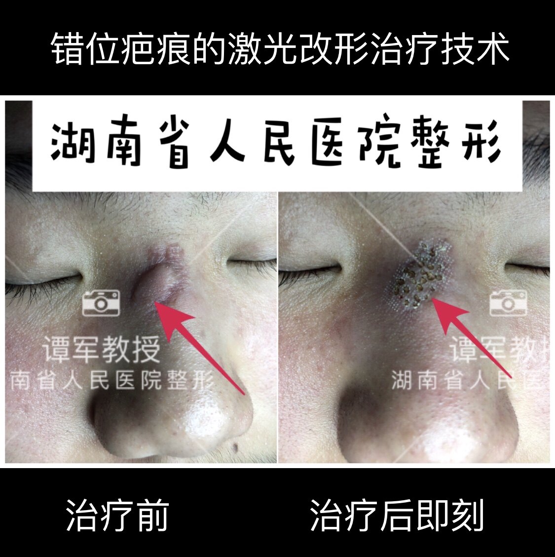 本文是谭军版权所有,未经授权请勿转载.