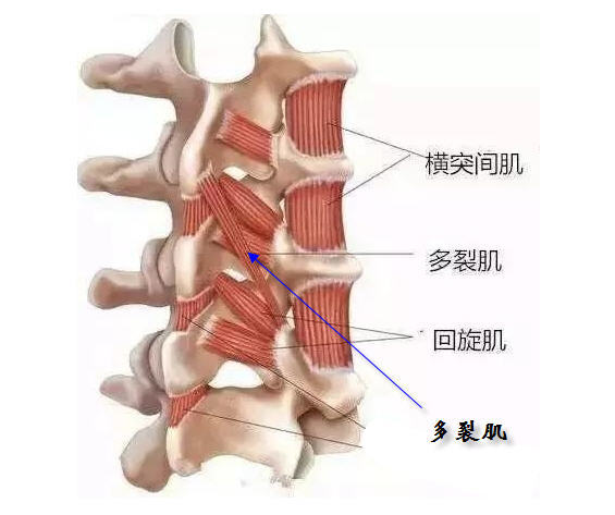 从解剖位置上看,多裂肌位于脊柱最内侧,是附着面积最大的椎旁肌,由多