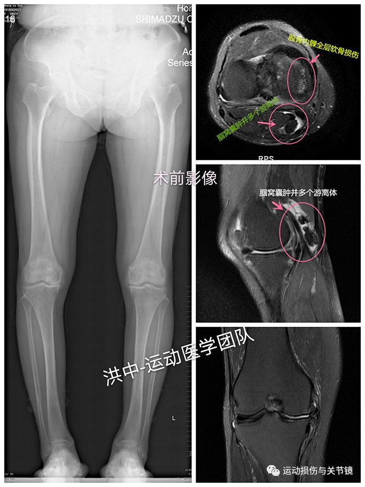 暂无