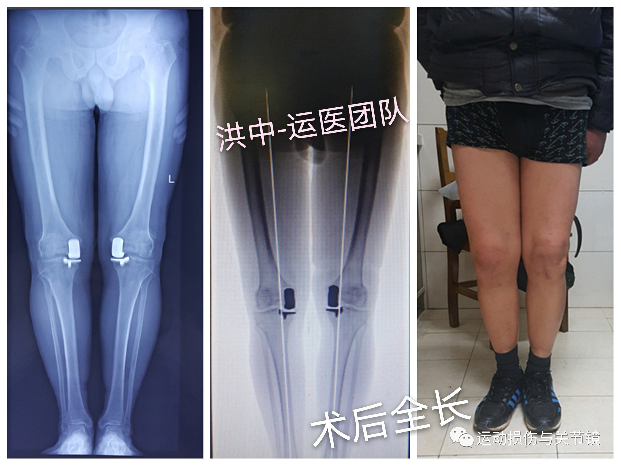 暂无