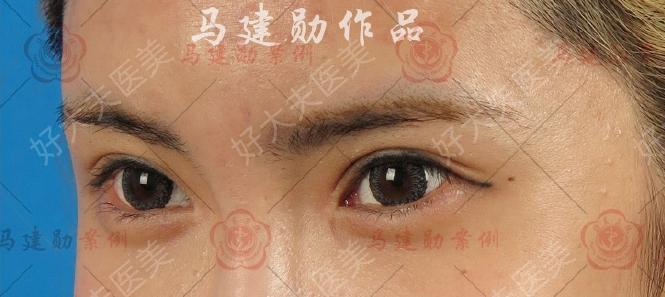 圖文圖片