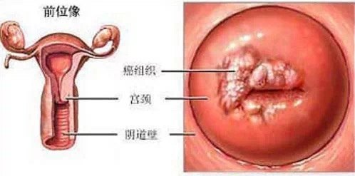 暂无