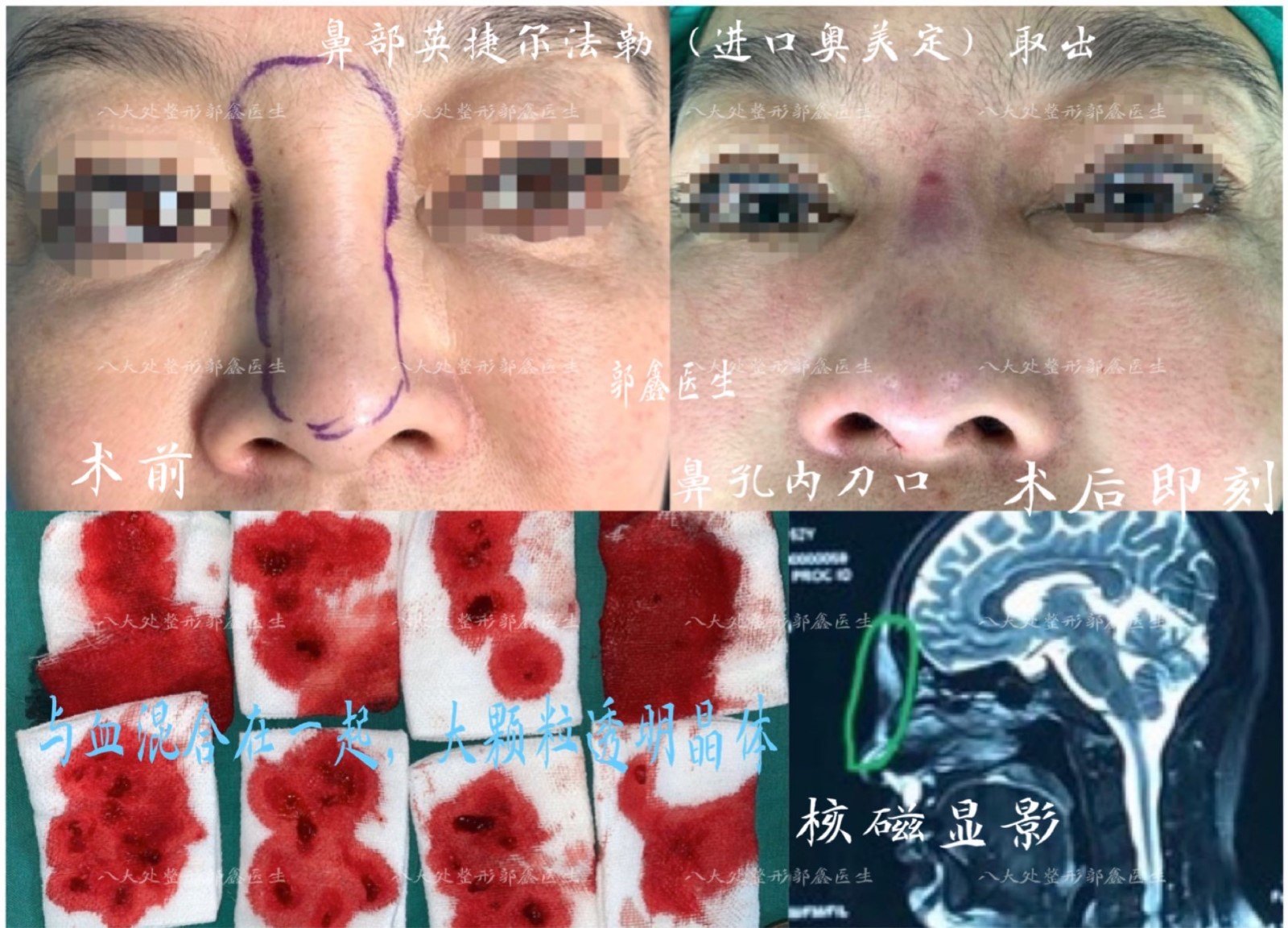 case007-2副本1.jpg