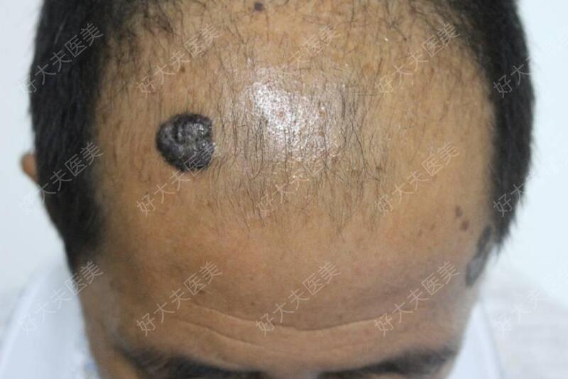 圖文圖片
