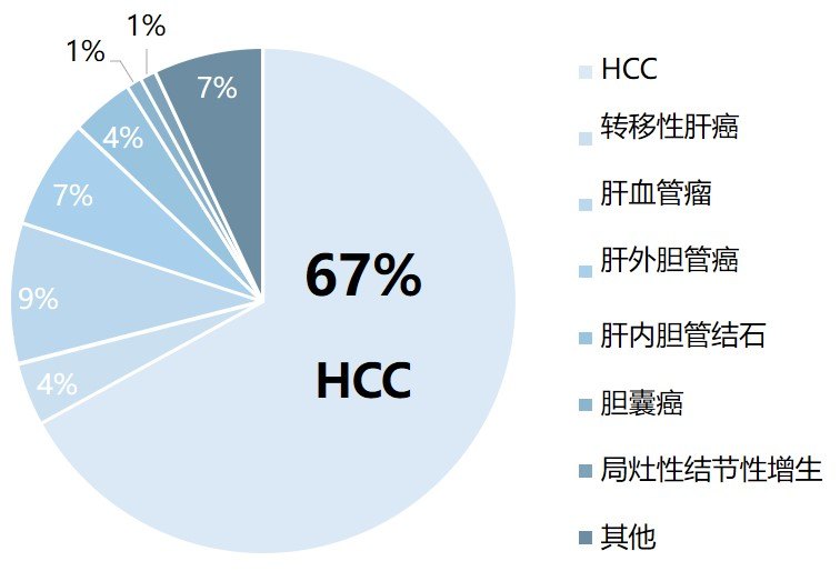 中国是乙肝大国,肝癌发生率及死亡率高,2018年统计中国肝癌新发肿瘤数