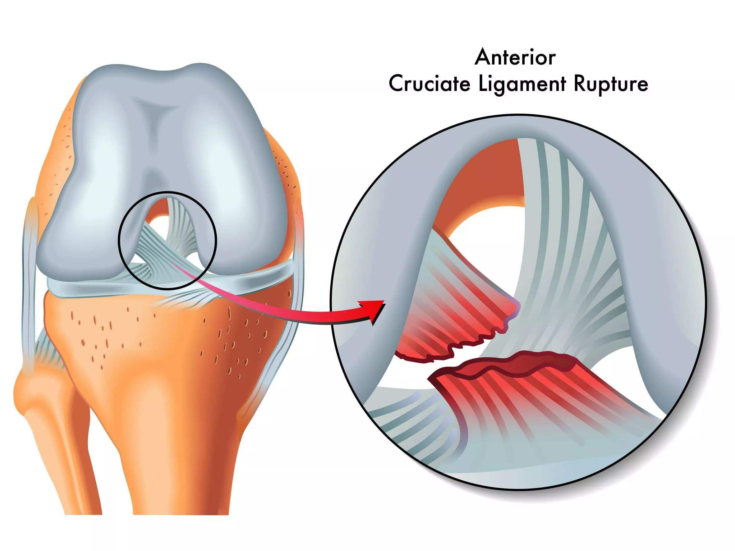 annular ligament图片