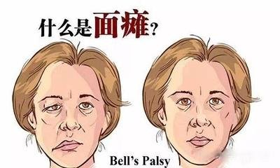 圖文圖片
