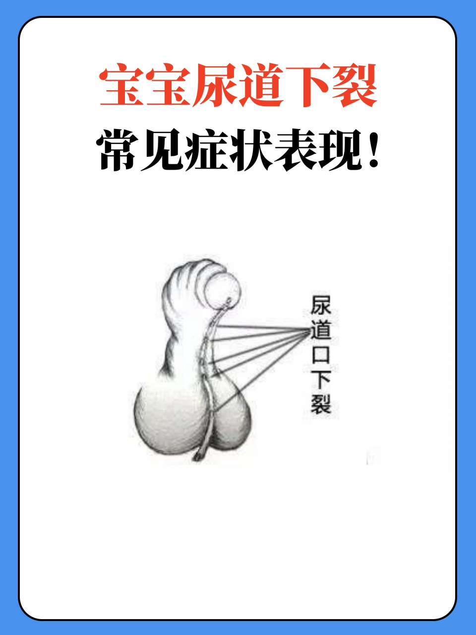 了解儿童泌尿系统常见疾病