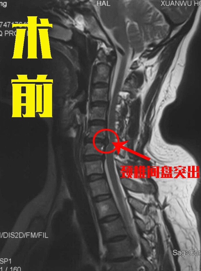 圖文圖片