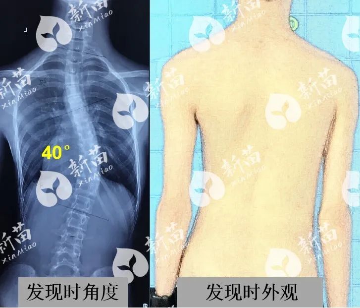 圖文圖片