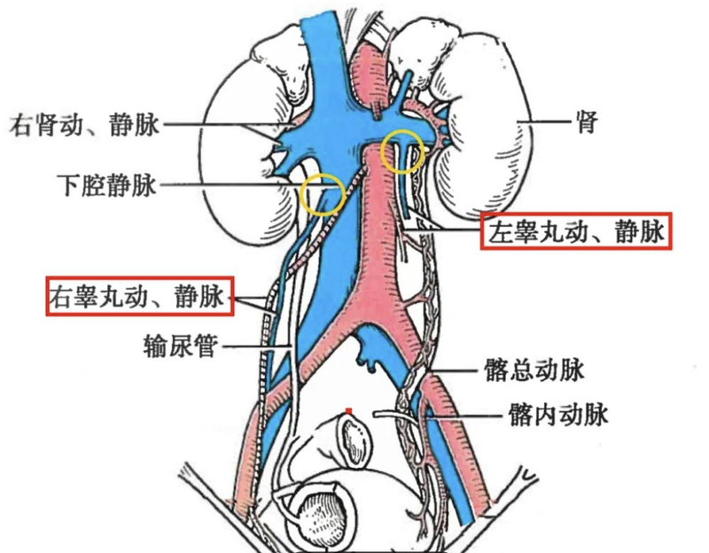 精索静脉曲张:男性生育路上的 “隐形障碍”?_精索静脉曲张_介绍_如何预防 - 好大夫在线