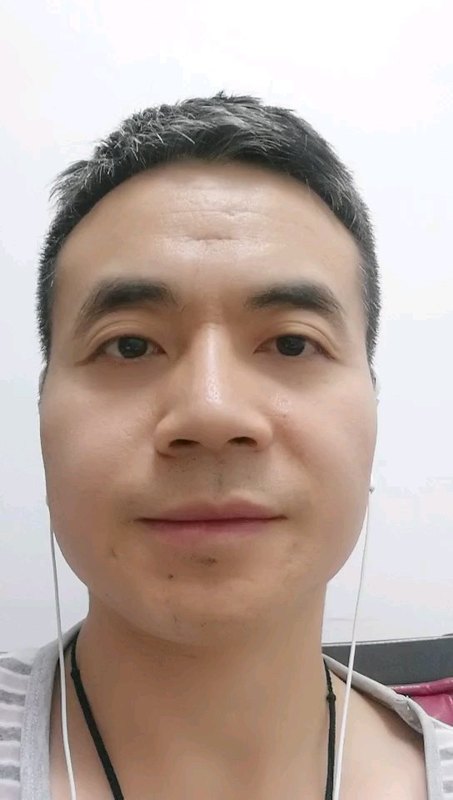 抗链O（ASO）阳性该怎么办？