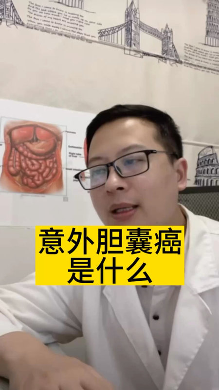 意外胆囊癌是什么？严重吗？