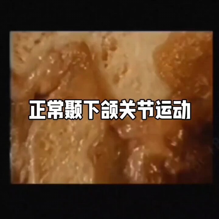 颞下颌关节