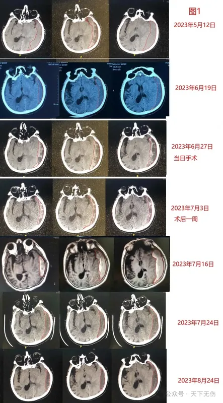 圖文圖片