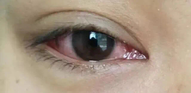 圖文圖片