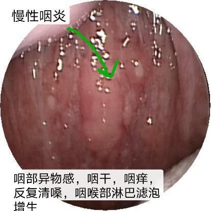 圖文圖片