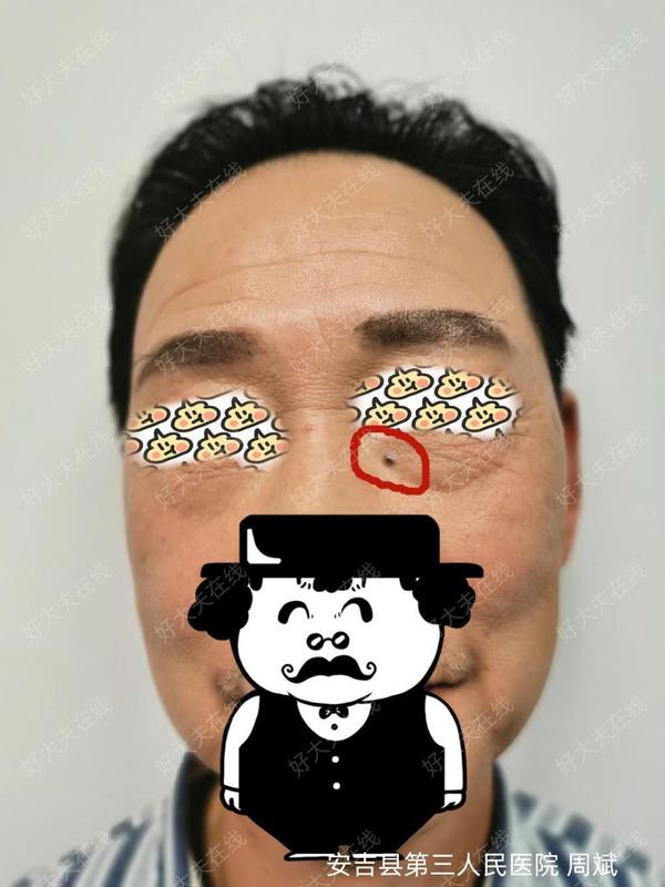 圖文圖片