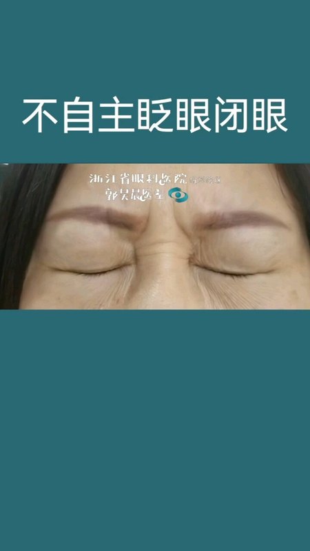 两次倒睫手术仍然复发罪魁祸首竟是它