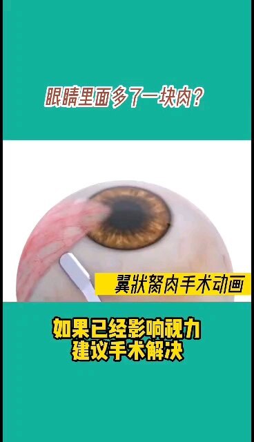 翼状胬肉手术动画演示