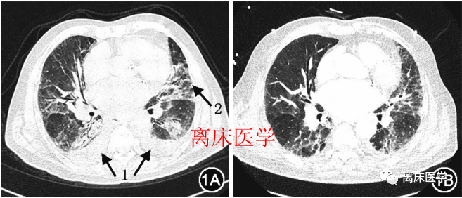 圖文圖片