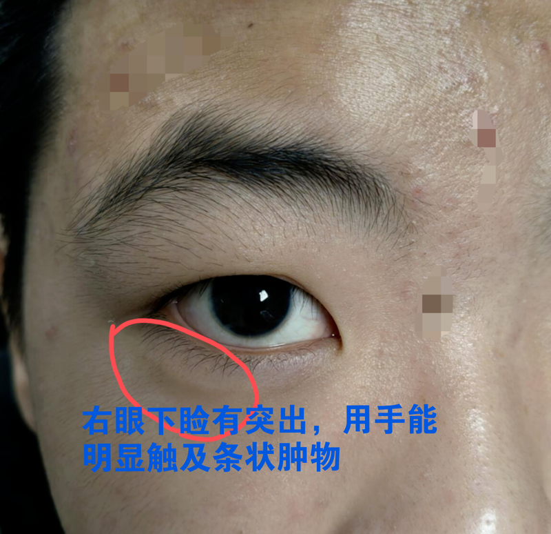 圖文圖片