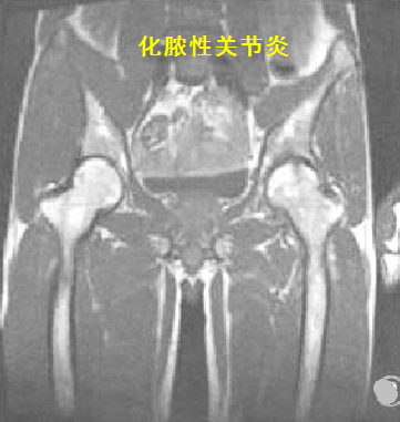 圖文圖片