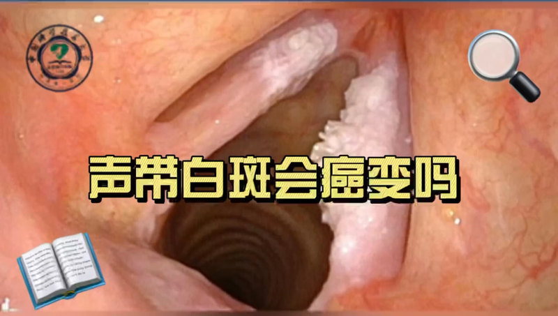 視頻封面