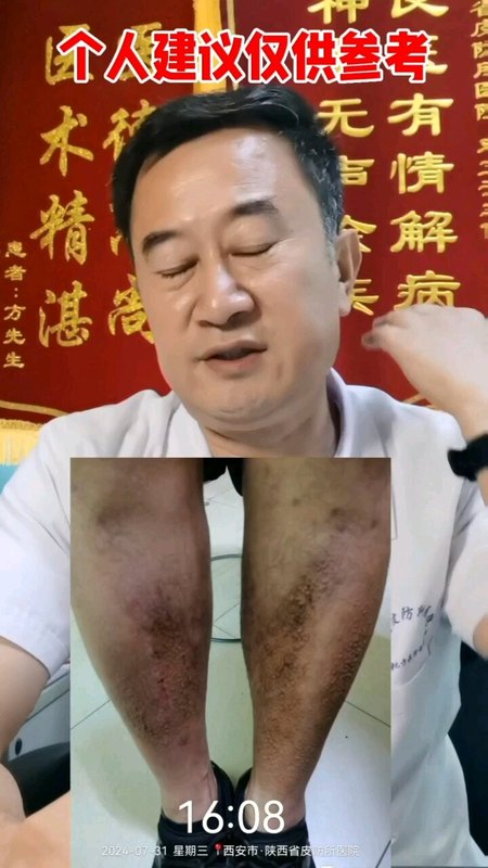 視頻封面