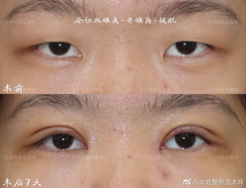 中國醫(yī)學科學院整形外科醫(yī)院核磁加急的簡單介紹