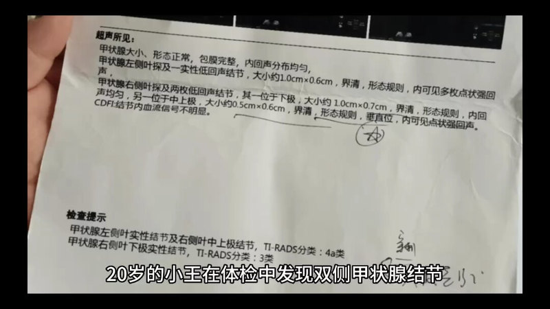 双侧甲状腺癌如何保住甲状腺