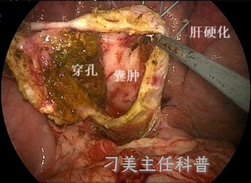圖文圖片