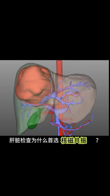 肝脏检查为什么首选磁共振