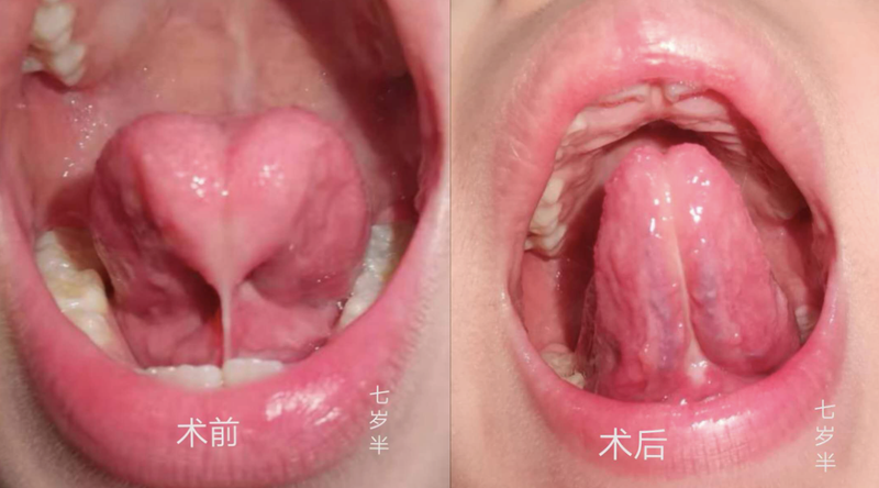 圖文圖片