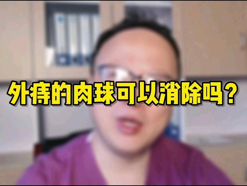 外痔的肉球可以消除吗？