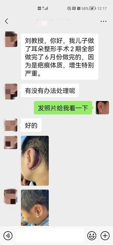 圖文圖片
