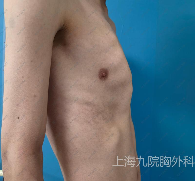 圖文圖片