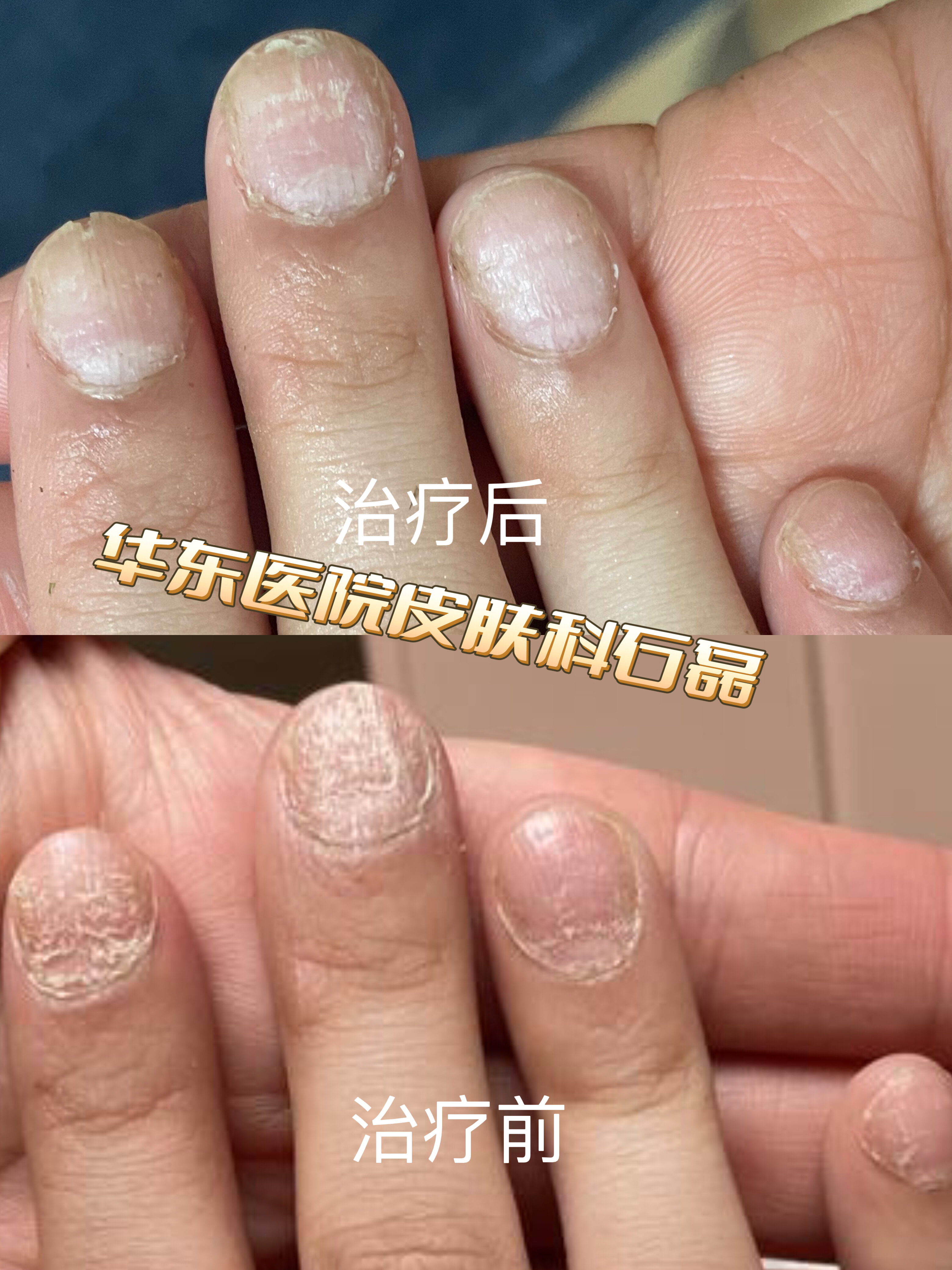 圖文圖片