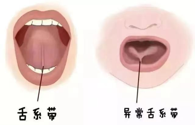 圖文圖片