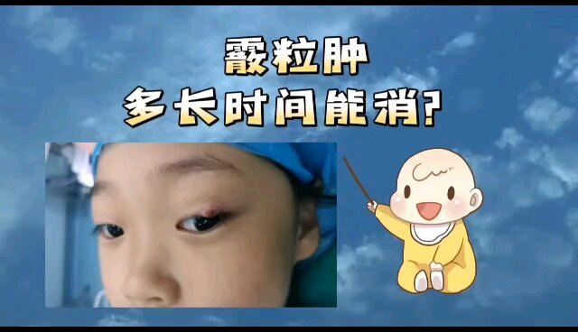霰粒肿多长时间能消退？
