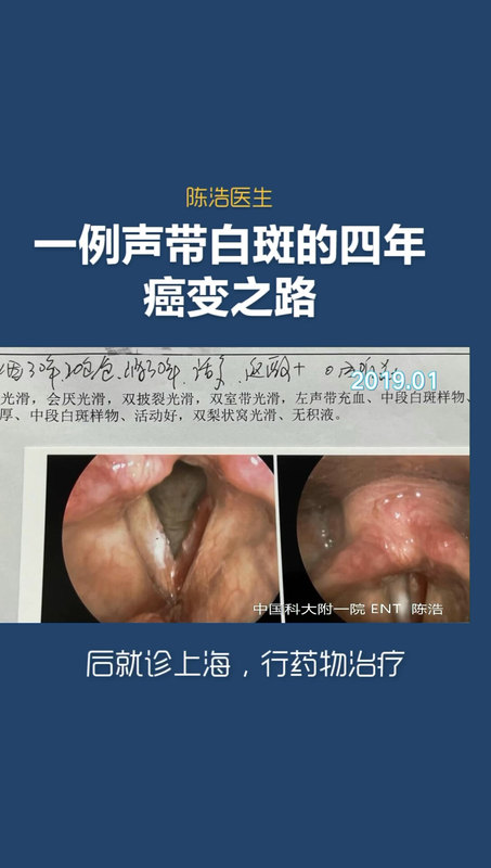 視頻封面