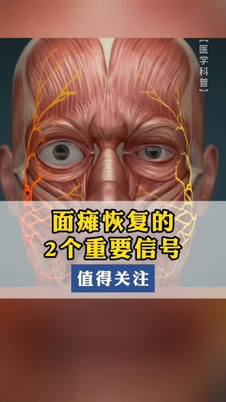 視頻封面