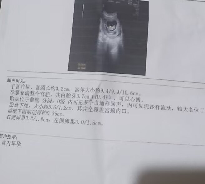 圖文圖片